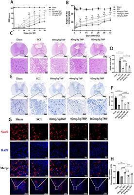 Tetramethylpyrazine inhibits ferroptosis in spinal cord injury by regulating iron metabolism through the NRF2/ARE pathway